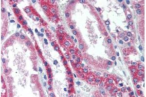 Human Kidney (formalin-fixed, paraffin-embedded) stained with TNFRSF11A antibody ABIN296495 at 10 ug/ml followed by biotinylated goat anti-rabbit IgG secondary antibody ABIN481713, alkaline phosphatase-streptavidin and chromogen. (TNFRSF11A anticorps  (AA 603-613))