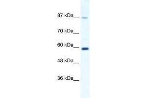 WB Suggested Anti-KIF23 Antibody Titration:  1. (KIF23 anticorps  (N-Term))