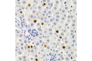 Immunohistochemistry of paraffin-embedded rat liver using GEMIN2 Antibody (ABIN1872798) at dilution of 1:200 (40x lens). (SIP1 anticorps)
