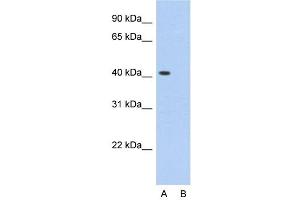Host:  Rabbit  Target Name:  PCBP1  Sample Type:  HepG2  Lane A:  Primary Antibody  Lane B:  Primary Antibody + Blocking Peptide  Primary Antibody Concentration:  2. (PCBP1 anticorps  (Middle Region))