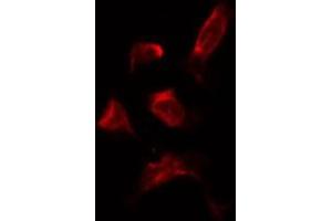 ABIN6278185 staining HepG2 by IF/ICC. (PNPLA2 anticorps  (Internal Region))