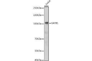 Western blot analysis of extracts of Jurkat cells, using S antibody (ABIN6130296, ABIN6147396, ABIN6147398 and ABIN6221485) at 1:1000 dilution. (SATB1 anticorps  (AA 484-763))