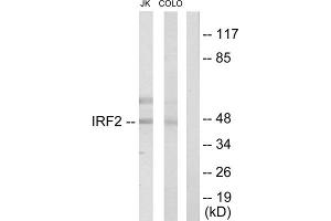 Western blot analysis of extracts from Jurkat cells and COLO205 cells, using IRF2 antibody. (IRF2 anticorps  (Internal Region))
