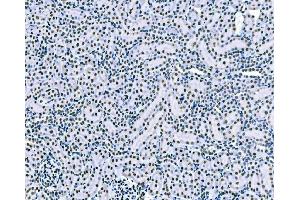 IHC analysis of splicing factor 1 using anti-splicing factor 1 antibody (ABIN7600193). (Splicing Factor 1 anticorps  (AA 160-266))