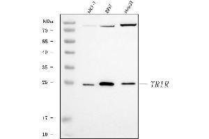 Western blot analysis of TRIR using anti-TRIR antibody (ABIN7603244). (Uncharacterized Protein C19orf43 (TRIR) (N-Term) anticorps)