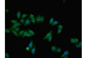 Immunofluorescent analysis of HepG2 cells using ABIN7143786 at dilution of 1:100 and Alexa Fluor 488-congugated AffiniPure Goat Anti-Rabbit IgG(H+L)