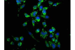 Immunofluorescence staining of Hela cells with ABIN7174460 at 1:166, counter-stained with DAPI.