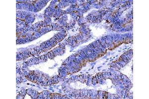 IHC analysis of Claudin 7/CLDN-7 using anti-Claudin 7/CLDN-7 antibody (ABIN7602665).