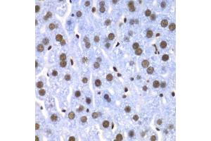 Immunohistochemistry of paraffin-embedded mouse liver using SF3B2 antibody.