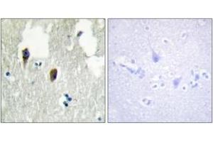 Immunohistochemistry analysis of paraffin-embedded human brain tissue, using KLHL3 Antibody. (KLHL3 anticorps  (AA 10-59))