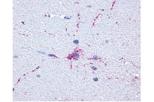 Brain, Neurons and Glia (GRM8 anticorps  (C-Term))