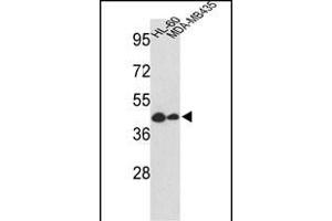 Western blot analysis of GSDMB Antibody (Center) (ABIN652499 and ABIN2842335) in HL-60, MDA-M cell line lysates (35 μg/lane). (Gasdermin B anticorps  (AA 208-237))