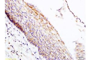 Formalin-fixed and paraffin embedded rat skin tissue labeled with Anti-PER2/Period circadian protein 2 Polyclonal Antibody, Unconjugated  at 1:200 followed by conjugation to the secondary antibody and DAB staining
