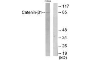 Western blot analysis of extracts from HeLa cells, using Catenin-beta1 Antibody. (CTNNB1 anticorps  (AA 626-675))