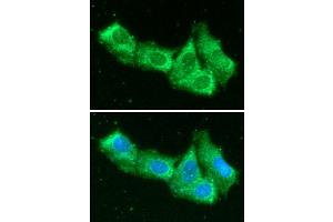 ICC/IF analysis of AIMP1 in Hep3B cells line, stained with DAPI (Blue) for nucleus staining and monoclonal anti-human AIMP1 antibody (1:100) with goat anti-mouse IgG-Alexa fluor 488 conjugate (Green). (EMAP-II/AIMP1 (AA 1-336) anticorps)