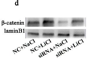 Knockdown of BAMBI suppressed Wnt/β-catenin signaling.