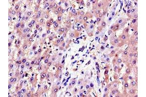 Immunohistochemistry of paraffin-embedded human liver tissue using ABIN7143701 at dilution of 1:100