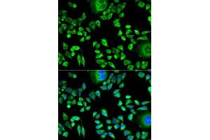 anti-Cystatin A (Stefin A) (CSTA) (AA 1-98) antibody