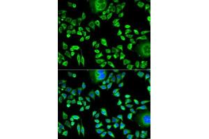 Immunofluorescence analysis of HeLa cells using CSTA antibody . (CSTA anticorps  (AA 1-98))