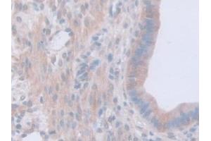 Detection of GAMT in Mouse Uterus Tissue using Polyclonal Antibody to Guanidinoacetate-N-Methyltransferase (GAMT)