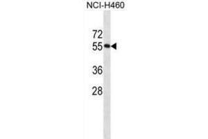 Western Blotting (WB) image for anti-RNA Binding Motif Protein 45 (RBM45) antibody (ABIN2998651) (RBM45 anticorps)