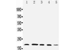 Anti-Diubiquitin antibody, Western blotting Lane 1: HELA Cell Lysate Lane 2: SKOV Cell Lysate Lane 3: MCF-7 Cell Lysate Lane 4: A549 Cell Lysate Lane 5: SMMC Cell Lysate (UBD anticorps  (N-Term))