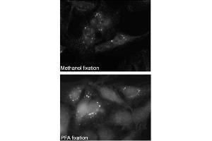 Immunofluorescence staining of Autophagy SQSTM1 (p62) Antibody (C-term) (ABIN388979 and ABIN2850435) on Methanol-fixed and PFA fixed HeLa cells.