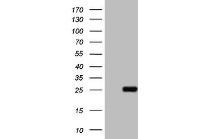 Western Blotting (WB) image for anti-ATP-Binding Cassette, Sub-Family C (CFTR/MRP), Member 5 (ABCC5) antibody (ABIN2715616) (ABCC5 anticorps)