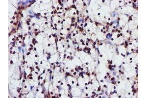 Image no. 1 for anti-Glutathione S-Transferase theta 2 (GSTT2) antibody (ABIN1498553) (GSTT2 anticorps)