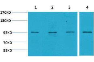 Western Blotting (WB) image for anti-Mitogen-Activated Protein Kinase 6 (MAPK6) antibody (ABIN3179032) (MAPK6 anticorps)
