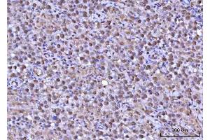 IHC analysis of RNF34 using anti-RNF34 antibody (ABIN7602457).