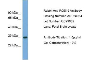 WB Suggested Anti-RGS19  Antibody Titration: 0. (RGS19 anticorps  (N-Term))
