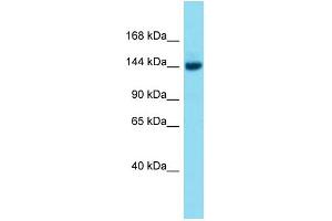 Host:  Rabbit  Target Name:  Brpf3  Sample Type:  Mouse Liver lysates  Antibody Dilution:  1. (BRPF3 anticorps  (Middle Region))