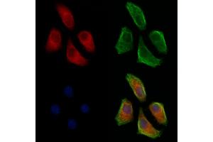 ABIN7093170 and ABIN7098475 staining Hela cells by IF/ICC. (C3 anticorps)