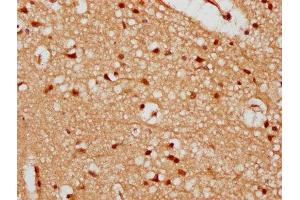 IHC image of ABIN7174162 diluted at 1:300 and staining in paraffin-embedded human brain tissue performed on a Leica BondTM system. (UTP18 anticorps  (AA 13-152))