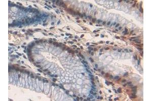 Detection of FZD1 in Human Stomach Tissue using Polyclonal Antibody to Frizzled Homolog 1 (FZD1) (FZD1 anticorps  (AA 117-322))