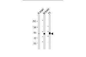All lanes : Anti-DCLK1 Antibody at 1:4000 dilution Lane 1: human brain lysate Lane 2: mouse brain lysate Lane 3: TT whole cell lysate Lysates/proteins at 20 μg per lane. (DCLK1 anticorps)