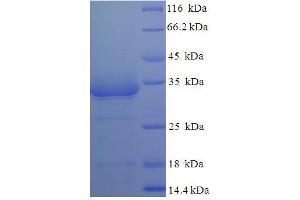 LPTA (AA 28-185) protein (His-SUMO Tag)