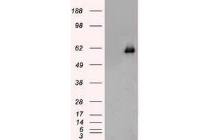 Image no. 9 for anti-Checkpoint Kinase 2 (CHEK2) antibody (ABIN1497496)