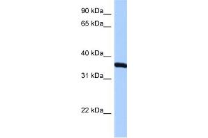 WB Suggested Anti-RPLP0 Antibody Titration:  0. (RPLP0 anticorps  (N-Term))