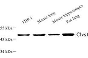 Western blot analysis of Clavesin 1 (ABIN7073517) at dilution of 1: 1000,Lane 1: THP-1 cell lysate,Lane 2: Mouse lung tissue lysate,Lane 3: Mouse hippocampus tissue lysate,Lane 4: Rat lung tissue lysate (Clavesin 1 anticorps)