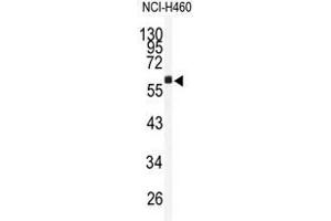 Western blot analysis of TMPRSS2 antibody (N-term) in NCI-H460 cell line lysates (35ug/lane).