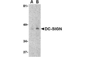 Western Blotting (WB) image for anti-CD209 (CD209) (Extracellular Domain) antibody (ABIN492511) (DC-SIGN/CD209 anticorps  (Extracellular Domain))