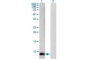 Western Blot analysis of S100A12 expression in transfected 293T cell line by S100A12 monoclonal antibody (M01), clone 1F10.