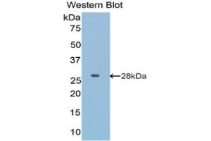 Western Blotting (WB) image for anti-Insulin-Like Growth Factor Binding Protein 5 (IGFBP5) (AA 27-248) antibody (ABIN5662063) (IGFBP5 anticorps  (AA 27-248))