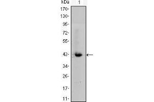 Western blot analysis using CTNNB1 mouse mAb against CTNNB1-hIgGFc transfected HEK293 cell lysate. (CTNNB1 anticorps)