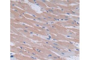 Used in DAB staining on fromalin fixed paraffin- embedded heart tissue