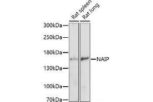 Western blot analysis of extracts of various cell lines using NAIP Polyclonal Antibody at dilution of 1:1000. (NAIP anticorps)
