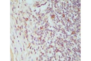 Immunohistochemistry of paraffin-embedded Human tonsil using CTLA4 Polyclonal Antibody at dilution of 1:100 (40x lens). (CTLA4 anticorps)