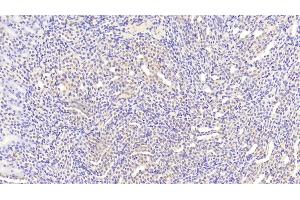 Detection of WISP1 in Mouse Kidney Tissue using Polyclonal Antibody to WNT1 Inducible Signaling Pathway Protein 1 (WISP1)